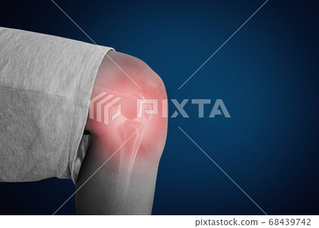 knee, pain, senior 68439742