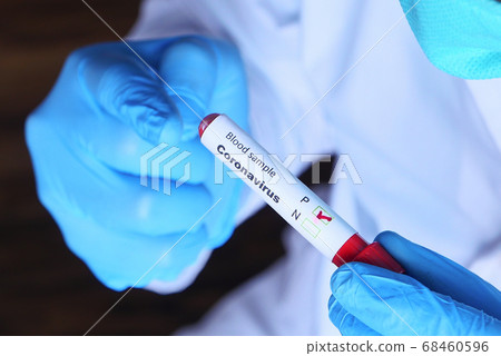 hands of laboratory technician holding blood test tube  68460596