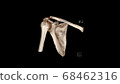 Computed Tomography Volume Rendering examination of the  Shoulder ( CT VR shoulder). 3D rendering Computed Tomography Volume Rendering examination of the  Shoulder ( CT VR shoulder). 3D rendering 68462316
