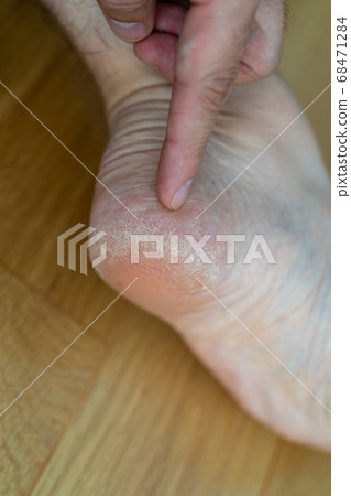 Ragged heels 68471284