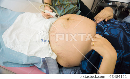 Smiling pregnant women ultrasound test with her Smiling pregnant women ultrasound test with her 68484131