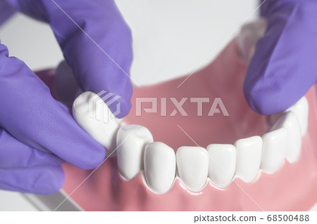 Dental model teeth is used to demonstration of Dental model teeth is used to demonstration of 68500488