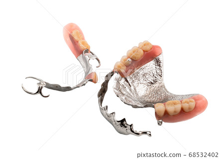 Set of partial metal upper and lower removable dentures on white background. 68532402