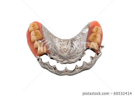 Removable partial metal denture swinglock type on white background. 68532414