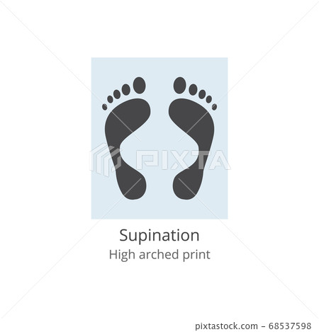 Supination - high arched print of human foot with medical deformity and leg anatomy problem 68537598