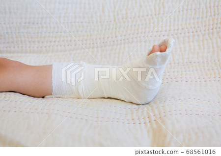 broken leg. Close-up of the cast on the feet. exercises to repair and strengthen muscles. damage to the bones. medical care of a surgeon in the emergency room broken leg. Close-up of the cast on the feet. exercises to repair and strengthen muscles. damage to the bones. medical care of a surgeon in the emergency room 68561016