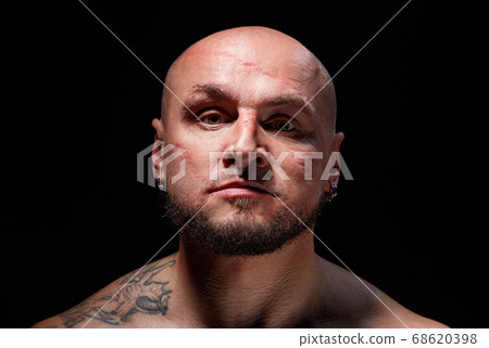 Photo of bald man with scars on face 68620398