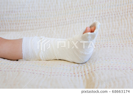 broken leg. Close-up of the cast on the feet. exercises to repair and strengthen muscles. damage to the bones. medical care of a surgeon in the emergency room 68663174