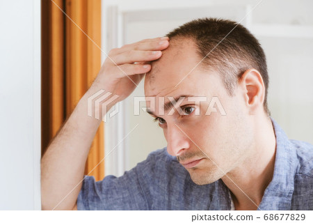 Young man looking at mirror worry about balding. 68677829