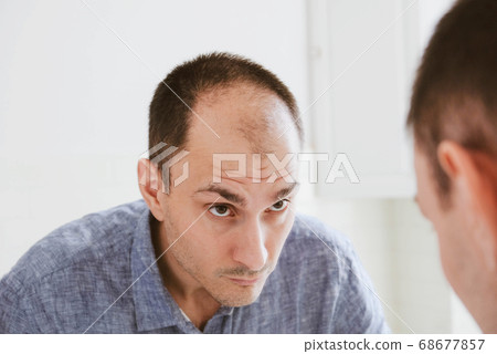 Young man looking at mirror worry about balding. Young man looking at mirror worry about balding. 68677857