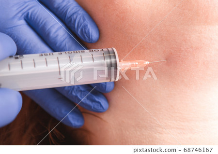 Cosmetologist injecting ozone to chin. Patient is sitting in chair with closed eyes. This therapy is purposed to increase oxygen in a body. 68746167