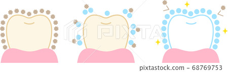 Tooth polyphosphoric acid whitening before after 68769753