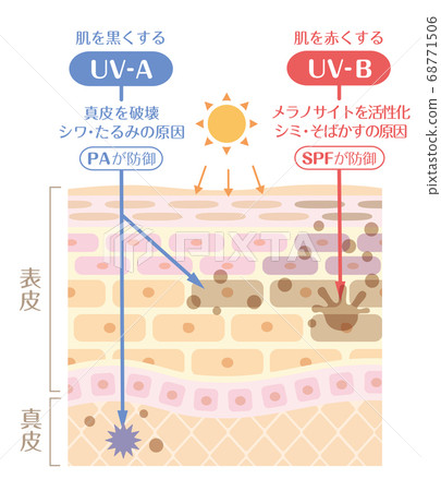 Skin Structure/Skin Structure_Sunburn Mechanism - Stock Illustration ...