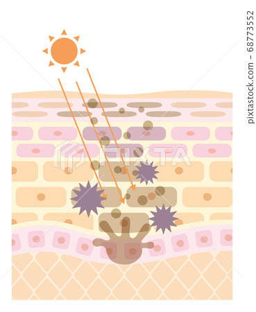 皮膚結構/皮膚結構_UV 68773552
