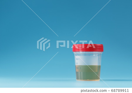 Urine in a test container with a red lid on a blue 68789911