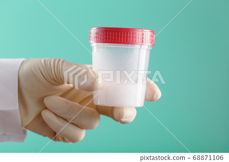 Semen in a jar for analysis in the doctor's hand Semen in a jar for analysis in the doctor's hand 68871106