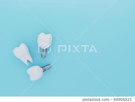 Tooth Crown and Tooth Implants on blue background Tooth Crown and Tooth Implants on blue background 68908825