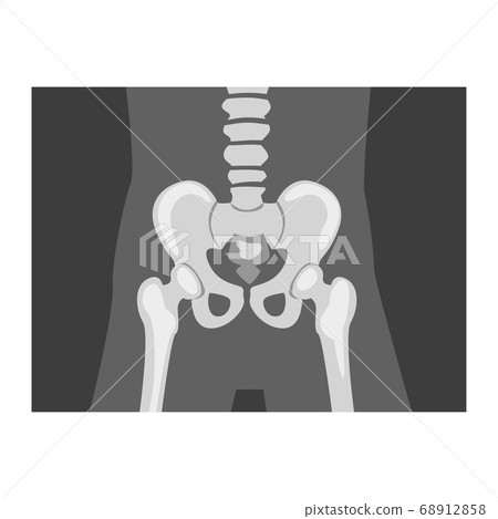 Roentgenograph of Coxofemoral Joint Front View Vector Image Roentgenograph of Coxofemoral Joint Front View Vector Image 68912858