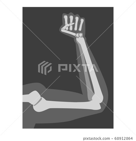 Roentgenograph of Forearm Front View Vector Image 68912864