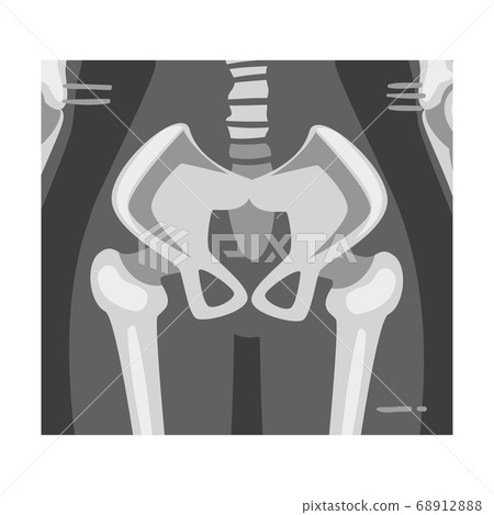 X-ray Film of Coxofemoral Joint Back View Vector Illustrated Image for Educational Purpose 68912888