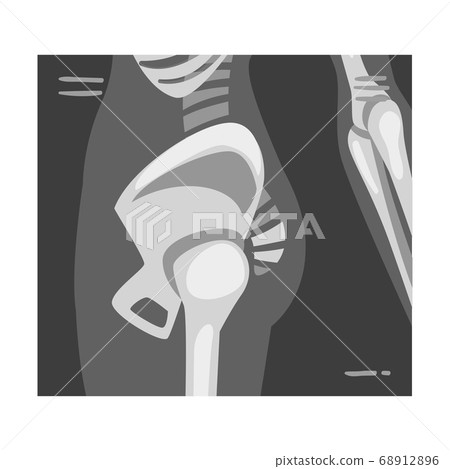 X-ray Film of Coxofemoral Joint Side View Vector Illustrated Image for Educational Purpose X-ray Film of Coxofemoral Joint Side View Vector Illustrated Image for Educational Purpose 68912896