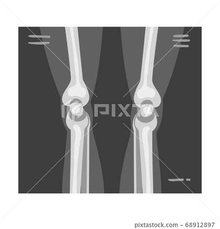 X-ray Film of Leg Joints Vector Illustrated Image for Educational Purpose 68912897