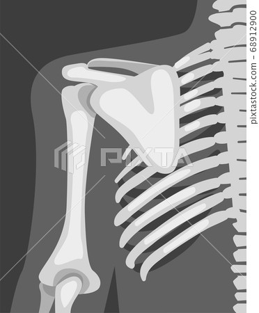 X-ray Film of Chest Vector Illustrated Image for Educational Purpose 68912900