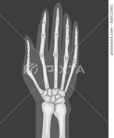 X-ray Film of Hand Vector Illustrated Image for Educational Purpose 68912901