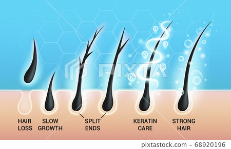 Different hair problems and deep salon treatment vector illustrations set, macro view of balding scalp skin and follicles Different hair problems and deep salon treatment vector illustrations set, macro view of balding scalp skin and follicles 68920196
