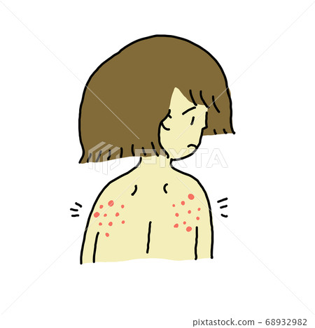 atopy, female, lady - Stock Illustration [68932982] - PIXTA