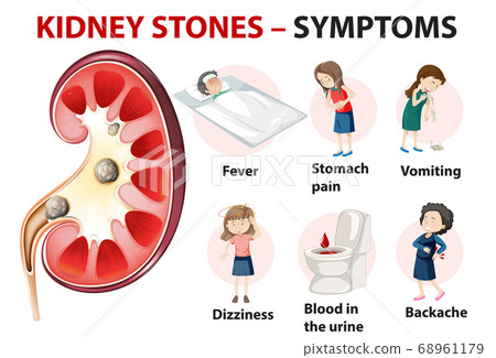 Kidney Stones Symptoms Cartoon Style Infographic Stock Illustration 68961179 Pixta