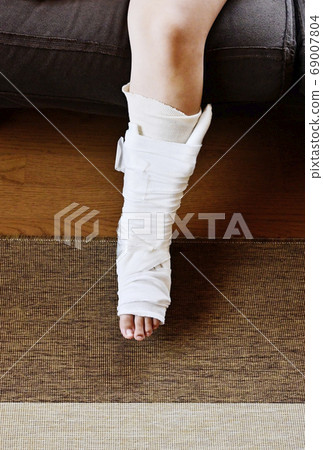 Image material for injured foot, casted foot, and sprained fractured foot 69007804