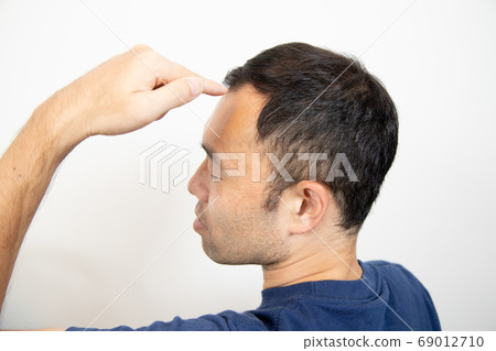 Middle aged man suffering thin hair Middle aged man suffering thin hair 69012710