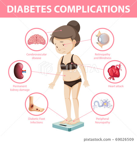 Diabetes complications information infographic Diabetes complications information infographic 69026509