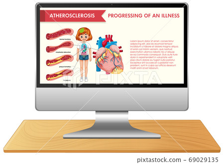 Computer with science infographic  on screen 69029135