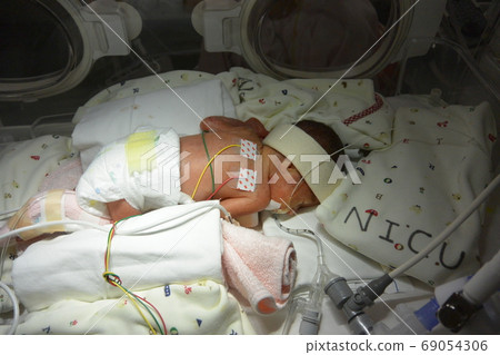 小出生的嬰兒在新生兒重症監護病房接受治療 69054306