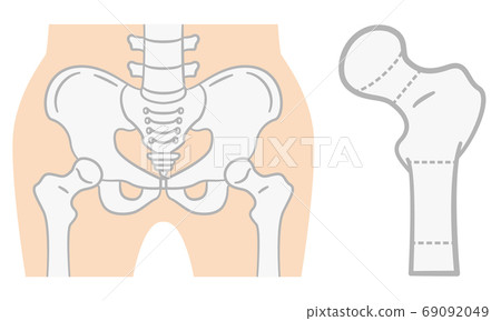 股骨近端分類 69092049