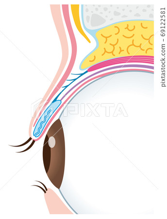 眼瞼下垂結構眼球截面 眼瞼下垂結構眼球截面 69122581