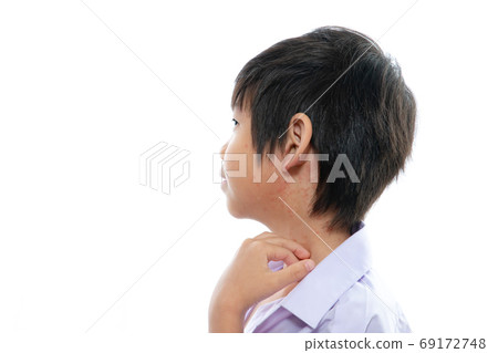 asian boy screatching his neck with rash on white asian boy screatching his neck with rash on white 69172748