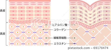 Healthy skin wrinkle skin cross section - Stock Illustration [69178474 ...