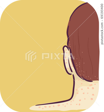 Symptom Head Neck Red Bump Lice Bites Illustration Symptom Head Neck Red Bump Lice Bites Illustration 69193400