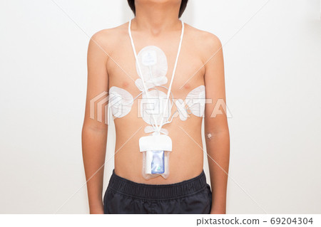 24-hour Holter ECG 69204304