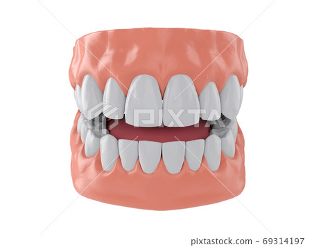 human jaw with white healthy straight teeth, correct bite, 3d render human jaw with white healthy straight teeth, correct bite, 3d render 69314197