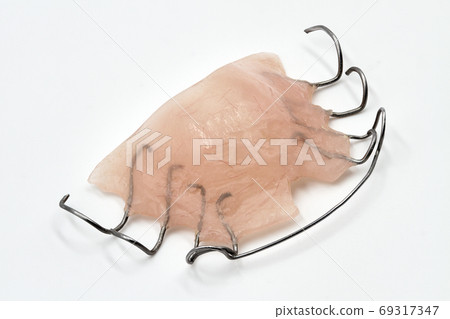 A removable orthodontic appliance on light 69317347