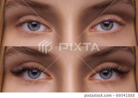 Eyelash Extension. Comparison of female eyes before and after. 69341888