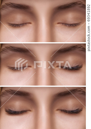 Eyelash Extension. Comparison of female eyes before and after. 69341892