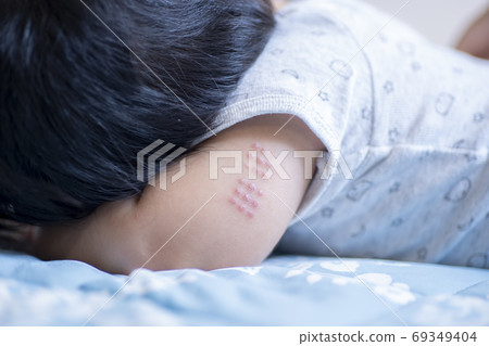 BCG trace of a 7-month-old boy 69349404