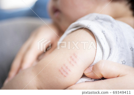 BCG trace of a 7-month-old boy 69349411