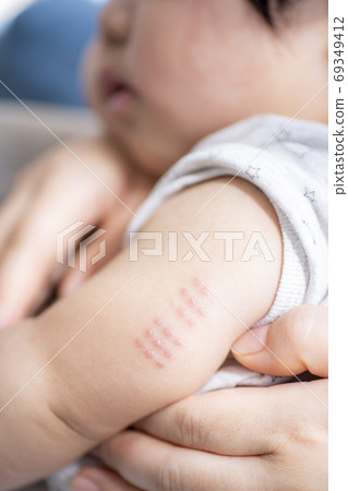 BCG trace of a 7-month-old boy 69349412