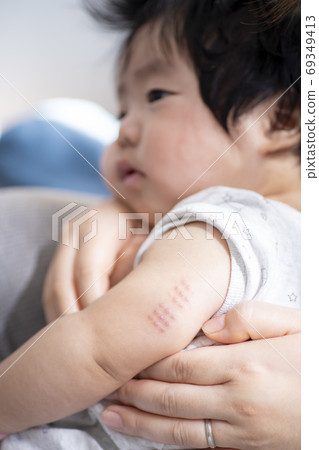 BCG trace of a 7-month-old boy 69349413
